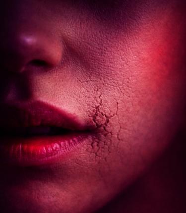 Close-up of cracked lips